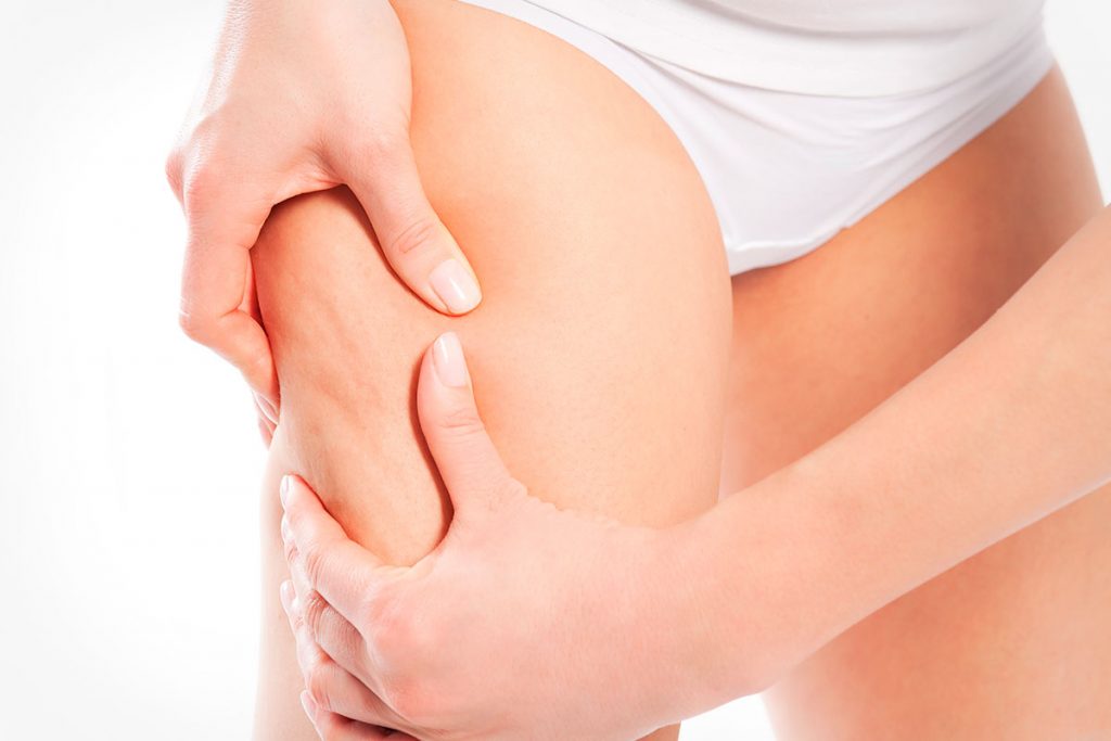 Lifting de muslos: la solución para lucir piernas este verano