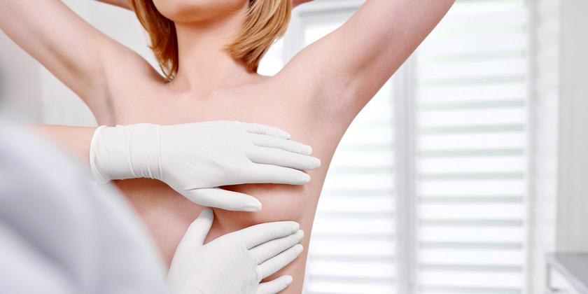 Mastopexia: beneficios estéticos y riesgos de elevar las mamas